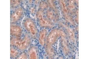 Used in DAB staining on fromalin fixed paraffin- embedded Kidney tissue (PCM1 antibody  (AA 15-210))