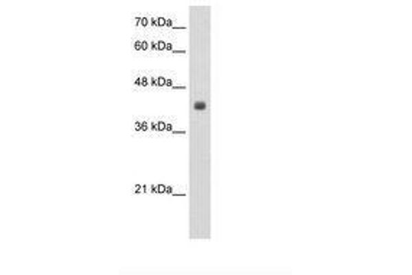 CCBL2 antibody  (N-Term)