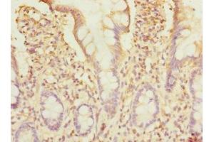 Immunohistochemistry of paraffin-embedded human small intestine tissue using ABIN7171247 at dilution of 1:100 (Syntaxin 7 antibody  (AA 1-170))