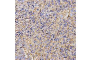 Immunohistochemistry (IHC) image for anti-Glycoprotein IX (Platelet) (GP9) antibody (ABIN1876562) (CD42a antibody)