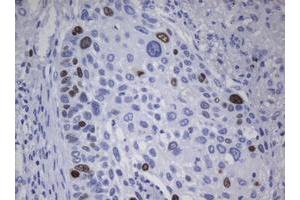 Image no. 1 for anti-Antigen Identified By Monoclonal Antibody Ki-67 (MKI67) (AA 1160-1493) antibody (ABIN1490856) (Ki-67 antibody  (AA 1160-1493))