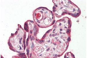 Human Placenta: Formalin-Fixed, Paraffin-Embedded (FFPE) (RILPL2 antibody  (Internal Region))