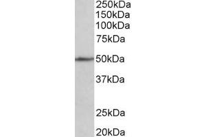 Western Blotting (WB) image for anti-Cell Adhesion Molecule 1 (CADM1) (AA 125-137) antibody (ABIN1100375) (CADM1 antibody  (AA 125-137))