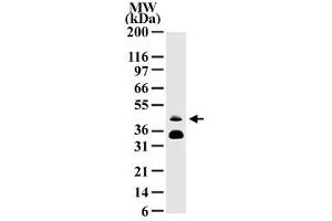 Western blot analysis of FOSB in HeLa cell lysate with FOSB monoclonal antibody, clone 83B1138  protein band with an approximate molecular weight of 46 kD is detected. (FOSB antibody  (AA 2-15))