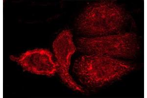 ABIN6268791 staining A-431 cells by ICC/IF. (Metabotropic Glutamate Receptor 5 antibody  (N-Term))
