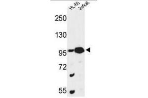 Western blot analysis of CSPP1 Antibody (N-term) in HL-60, Jurkat cell line lysates (35µg/lane). (CSPP1 antibody  (N-Term))