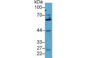 Detection of Smad4 in Human MCF7 cell lysate using Polyclonal Antibody to Mothers Against Decapentaplegic Homolog 4 (Smad4) (SMAD4 antibody  (AA 9-231))