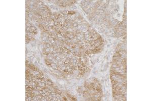 anti-Ribosomal Protein S3A (RPS3A) (AA 1-50) antibody