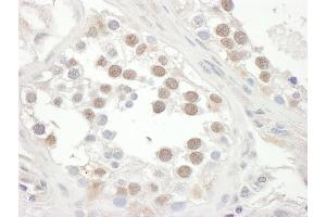 Immunohistochemistry (IHC) image for anti-Telomeric Repeat Binding Factor 2, Interacting Protein (TERF2IP) (AA 200-250) antibody (ABIN7453474)