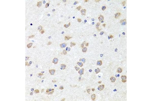 CHD1 antibody  (C-Term)