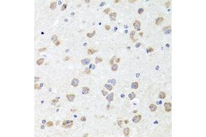 Immunohistochemistry of paraffin-embedded mouse brain using CHD1 antibody (ABIN6133620, ABIN6138500, ABIN6138501 and ABIN7101818) at dilution of 1:100 (40x lens). (CHD1 antibody  (C-Term))