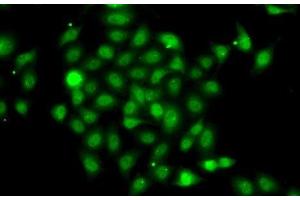 Immunofluorescence analysis of A-549 cells using COPS2 Polyclonal Antibody (COPS2 antibody)