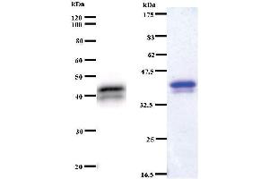 Left: ASXL1 staining. (ASXL1 antibody)