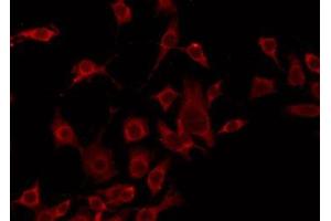 ABIN6275247 staining HeLa by IF/ICC. (TOMM20 antibody  (Internal Region))