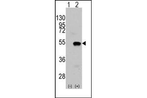 Image no. 1 for anti-SET and MYND Domain Containing 2a (SMYD2A) (N-Term) antibody (ABIN356582) (SMYD2A antibody  (N-Term))