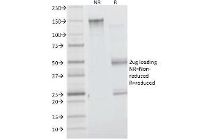 SDS-PAGE Analysis Purified Insulin Receptor Mouse Monoclonal Antibody (INSR/1661). (Insulin Receptor antibody  (Extracellular Domain))