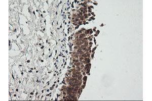 Image no. 2 for anti-Cyclin-Dependent Kinase Inhibitor 2B (p15, Inhibits CDK4) (CDKN2B) antibody (ABIN1497447) (CDKN2B antibody)