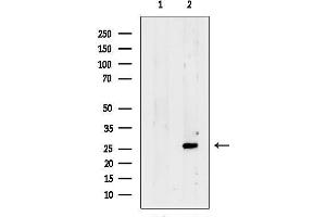 anti-SCAN Domain Containing 1 (SCAND1) (N-Term) antibody