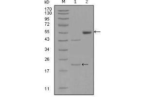 Western Blot showing EPHA5 antibody used against truncated EPHA5-His recombinant protein (1) and truncated EPHA5 (aa620-774)-hIgGFc transfected CHO-K1 cell lysate (2). (EPH Receptor A5 antibody  (AA 620-774))