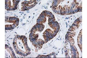 Image no. 1 for anti-Adenylate Kinase 4 (AK4) antibody (ABIN1496525) (AK4 antibody)