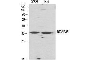 Western Blot (WB) analysis of specific cells using BRAF35 Polyclonal Antibody.