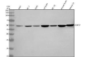 anti-Queuine tRNA-Ribosyltransferase Accessory Subunit 2 (QTRT2) (AA 142-386) antibody