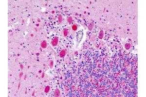 Anti-UCHL1 / PGP9. (UCHL1 antibody  (AA 187-214))