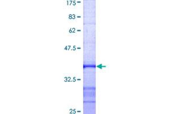 ube3a Protein (AA 51-150) (GST tag)