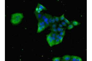 Immunofluorescent analysis of PC-3 cells using ABIN7153675 at dilution of 1:100 and Alexa Fluor 488-congugated AffiniPure Goat Anti-Rabbit IgG(H+L) (Gastrin-Releasing Peptide antibody  (AA 31-98))
