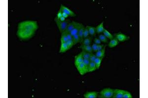 Immunofluorescent analysis of PC-3 cells using ABIN7153675 at dilution of 1:100 and Alexa Fluor 488-congugated AffiniPure Goat Anti-Rabbit IgG(H+L)
