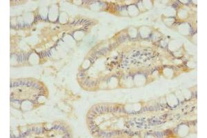 Immunohistochemistry of paraffin-embedded human small intestine tissue using ABIN7170170 at dilution of 1:100 (SLC23A1 antibody  (AA 173-259))