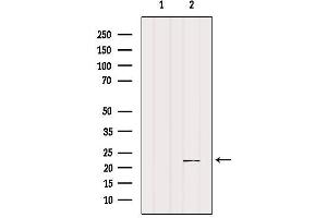 Western blot analysis of extracts from Mouse muscle, using SAR1A Antibody. (SAR1A antibody  (Internal Region))