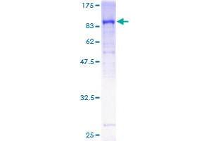 GUCY1B3 Protein (AA 1-619) (GST tag)