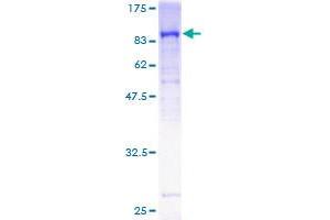Image no. 1 for Guanylate Cyclase 1, Soluble, beta 3 (GUCY1B3) (AA 1-619) protein (GST tag) (ABIN1306218) (GUCY1B3 Protein (AA 1-619) (GST tag))
