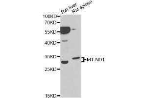 Western blot analysis of extracts of various cell lines, using MT-ND1 antibody. (MT-ND1 antibody)
