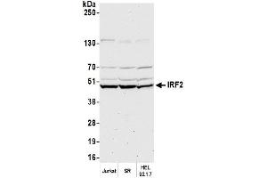 anti-Interferon Regulatory Factor 2 (IRF2) (AA 150-200) antibody