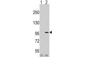 DDR1 antibody  (AA 299-330)