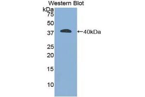 Detection of Recombinant GFAP, Mouse using Polyclonal Antibody to Glial Fibrillary Acidic Protein (GFAP) (GFAP antibody  (AA 253-354))