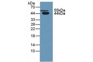 Detection of PCI in Human Urine using Polyclonal Antibody to Protein C Inhibitor (PCI) (SERPINA5 antibody  (AA 43-406))
