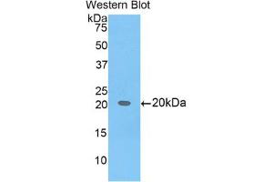Western blot analysis of the recombinant protein. (BCL2L2 antibody  (AA 22-189))