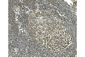 IHC analysis of Hsc70 using anti-Hsc70 antibody (ABIN7601962). (Hsc70 antibody  (AA 520-614))