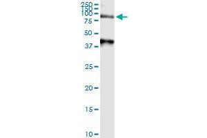 Immunoprecipitation of ARSA transfected lysate using anti-ARSA MaxPab rabbit polyclonal antibody and Protein A Magnetic Bead , and immunoblotted with ARSA purified MaxPab mouse polyclonal antibody (B01P) . (Arylsulfatase A antibody  (AA 1-507))