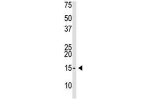 SUMO-3 antibody used in western blot to detect SUMO3 in Saos-2 cell lysate (SUMO3 antibody  (AA 38-64))