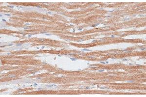 Immunohistochemistry of paraffin-embedded Rat heart using KATNA1 Polyclonal Antibody at dilution of 1:100 (40x lens). (KATNA1 antibody)