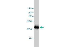 Western Blot detection against Immunogen (33. (S100A1 antibody  (AA 1-75))