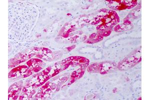 Anti-CRYAB / Alpha B Crystallin antibody IHC of human kidney. (CRYAB antibody)