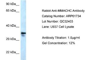 Western Blotting (WB) image for anti-Methylmalonic Aciduria (Cobalamin Deficiency) CblC Type, with Homocystinuria (MMACHC) (C-Term) antibody (ABIN2788885)