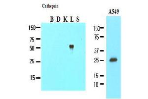 Western Blotting (WB) image for anti-Cathepsin L1 (CTSL1) (AA 114-333) antibody (ABIN317508)