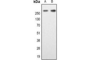 Western blot analysis of MAP2 expression in SKNSH (A), mouse brain (B) whole cell lysates. (MAP2 antibody  (N-Term))