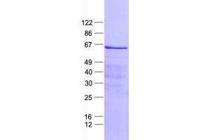 Validation with Western Blot